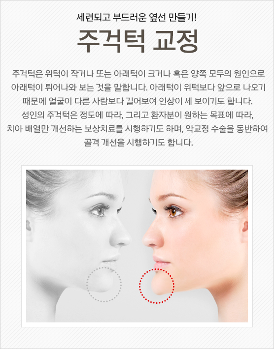 주걱턱